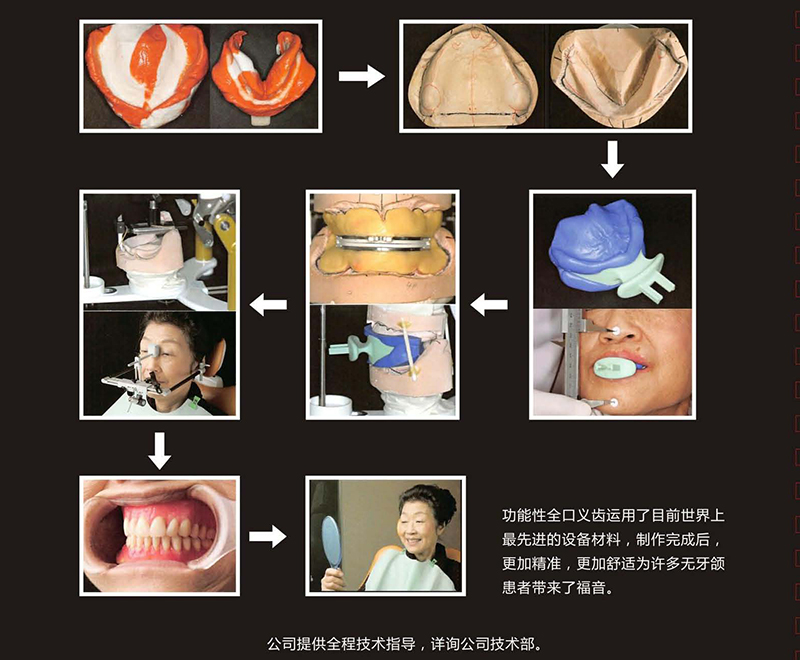 功能性全口修复